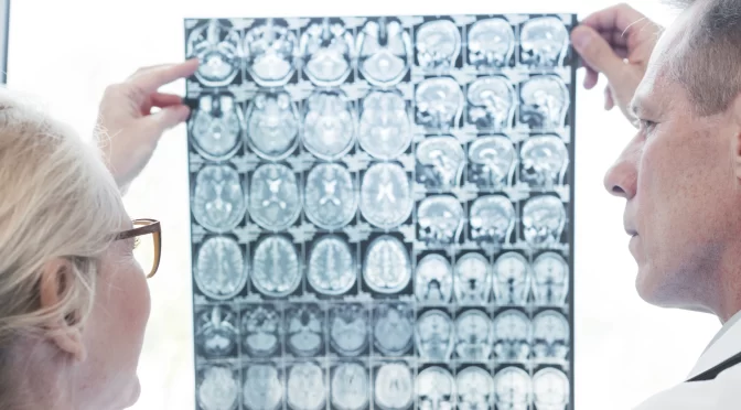 Tips to Choose the Right Medical Transport for Neurological Conditions 